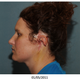 Illustration for article titled Woman Grows a New Ear on Her Arm, Has It Attached to Her Head (Warning: Graphic)